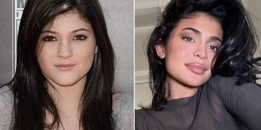 نجمات عالميات دفعهن التنمر إلى عمليات التجميل